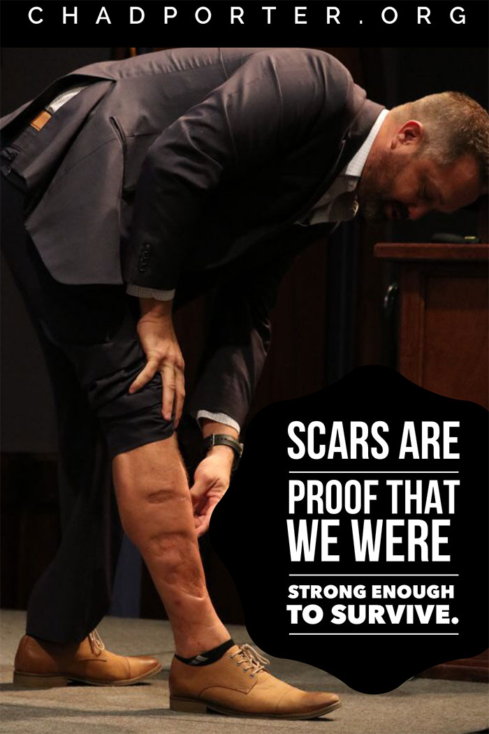 Inspirational typography featuring the quote about scars and strength.